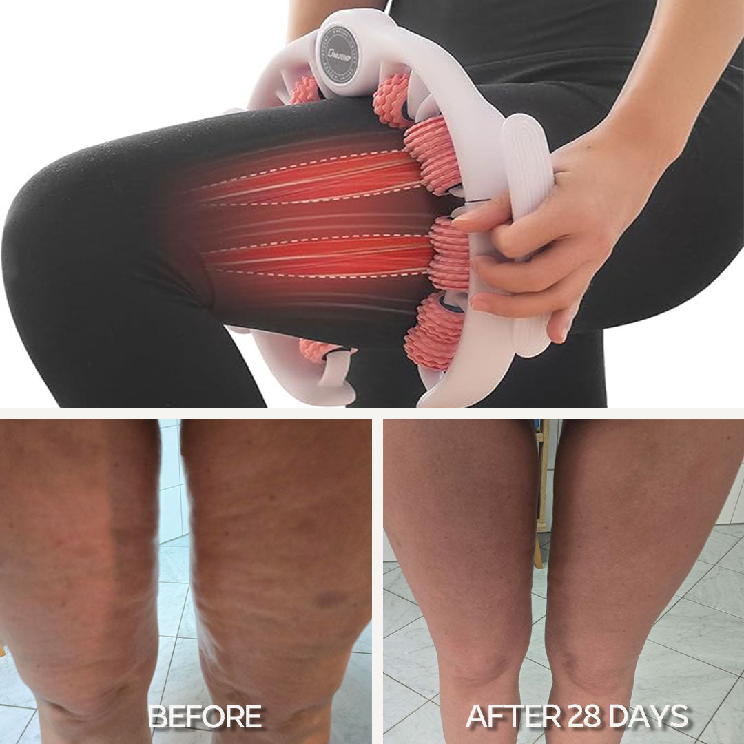 Anti-Cellulite Fascia Massager